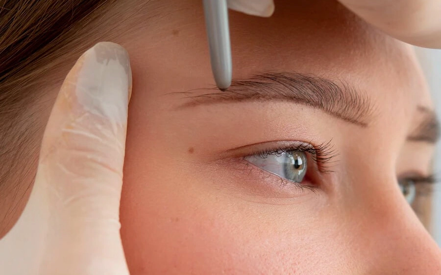 Eyebrows Transplant